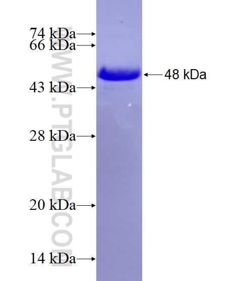 LAX1 fusion protein Ag16541 SDS-PAGE LAX1 fusion protein Ag16541 SDS-PAGE