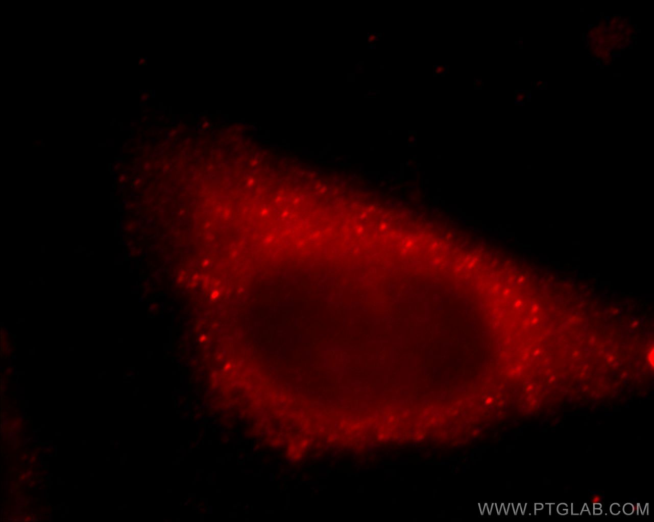 IF Staining of HepG2 using 20535-1-AP