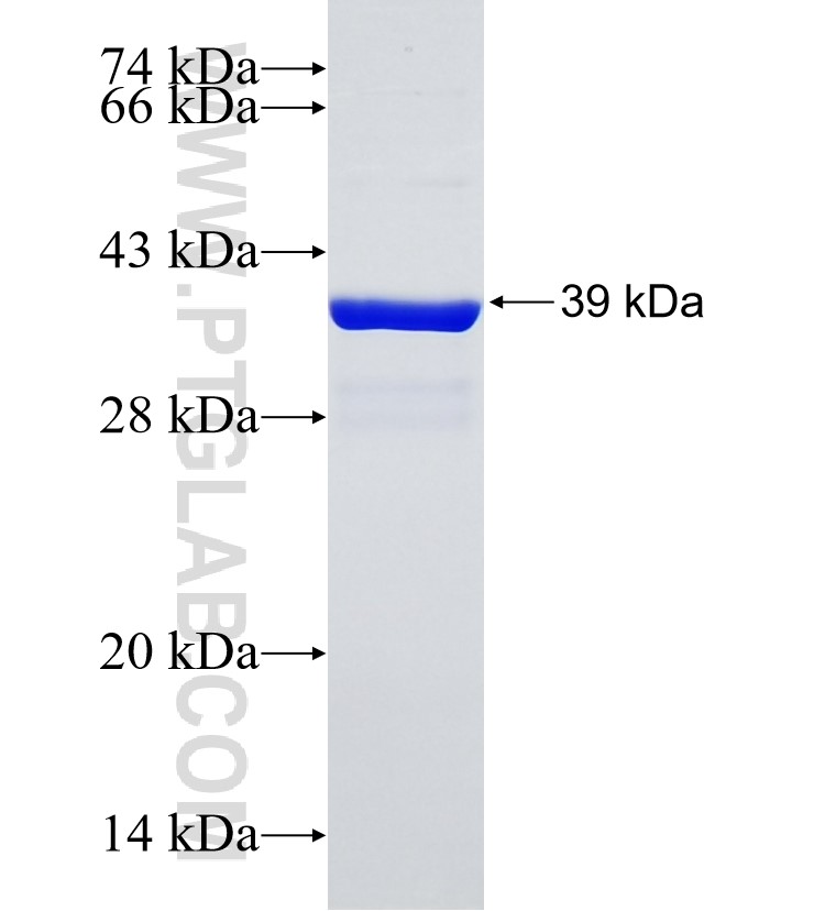 LBH fusion protein Ag34906 SDS-PAGE