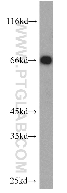 WB analysis of mouse liver using 11836-1-AP