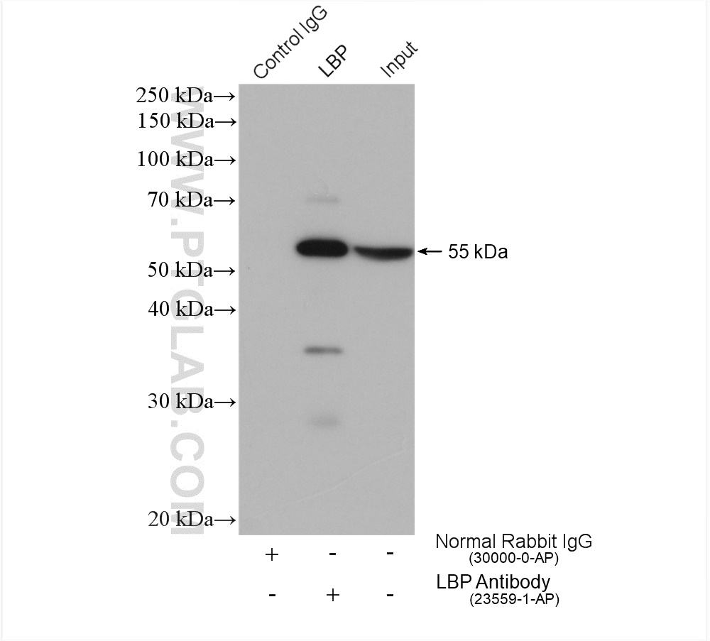 IP experiment of mouse liver using 23559-1-AP