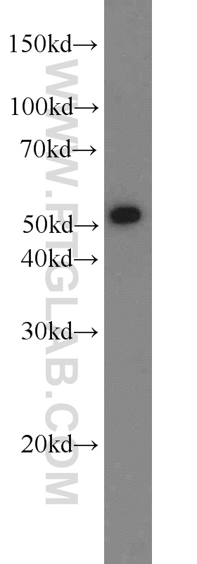 WB analysis of mouse liver using 23559-1-AP