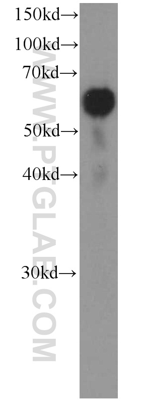 WB analysis of Jurkat using 66181-1-Ig (same clone as 66181-1-PBS)