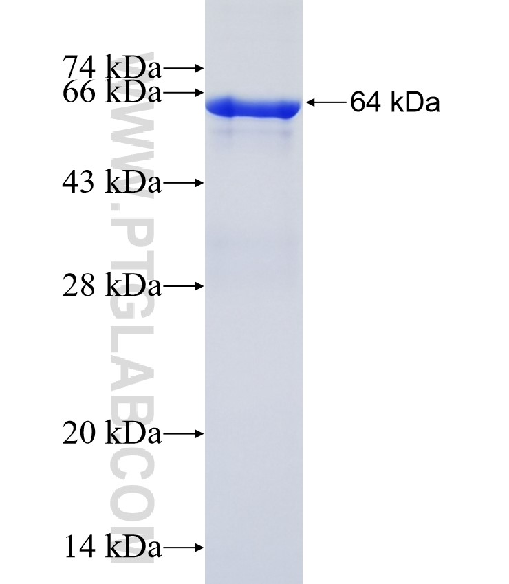 LBP fusion protein Ag2431 SDS-PAGE