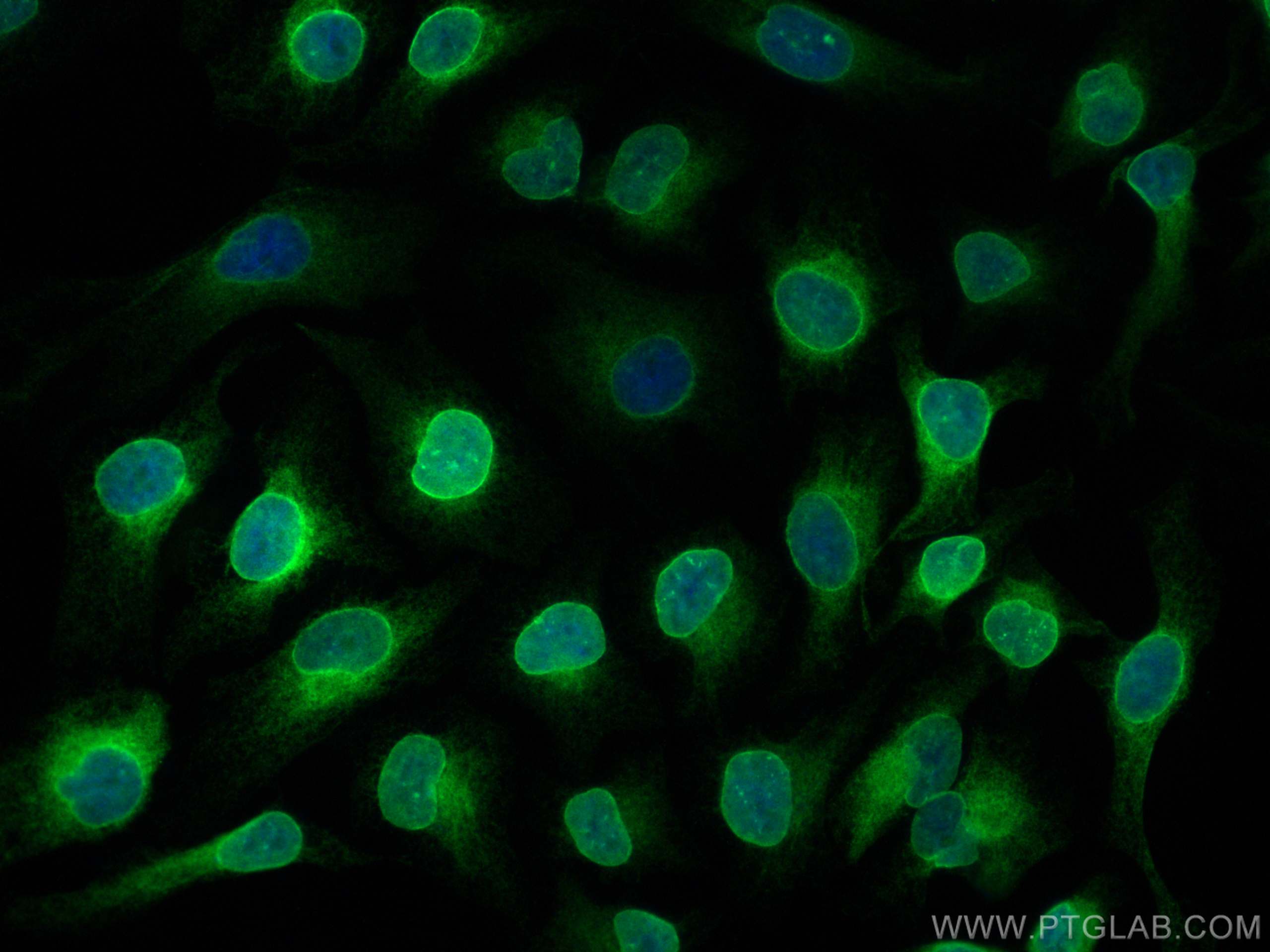IF Staining of HeLa using 12398-1-AP