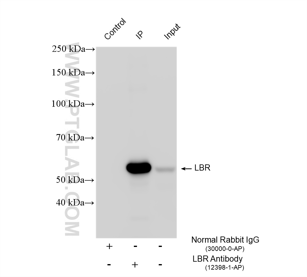 IP experiment of HeLa using 12398-1-AP