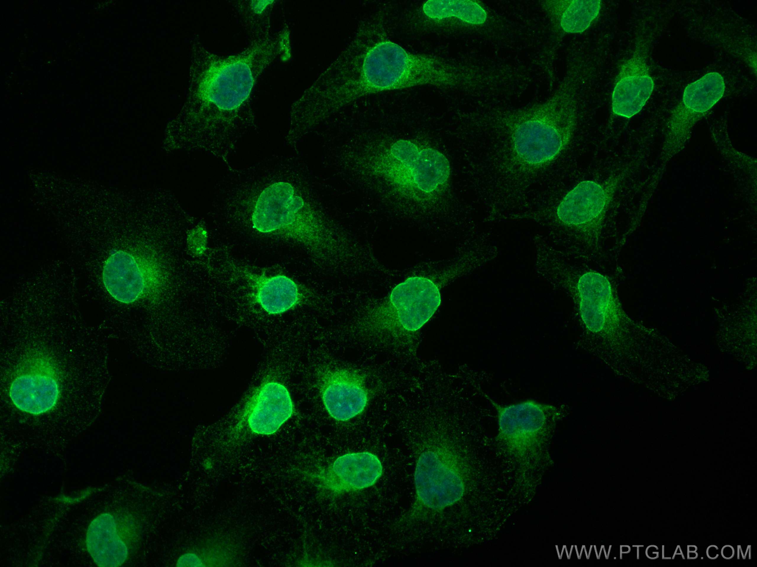 IF Staining of HeLa using 68378-1-Ig (same clone as 68378-1-PBS)