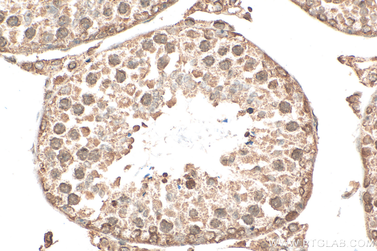 IHC staining of mouse testis using 68378-1-Ig (same clone as 68378-1-PBS)