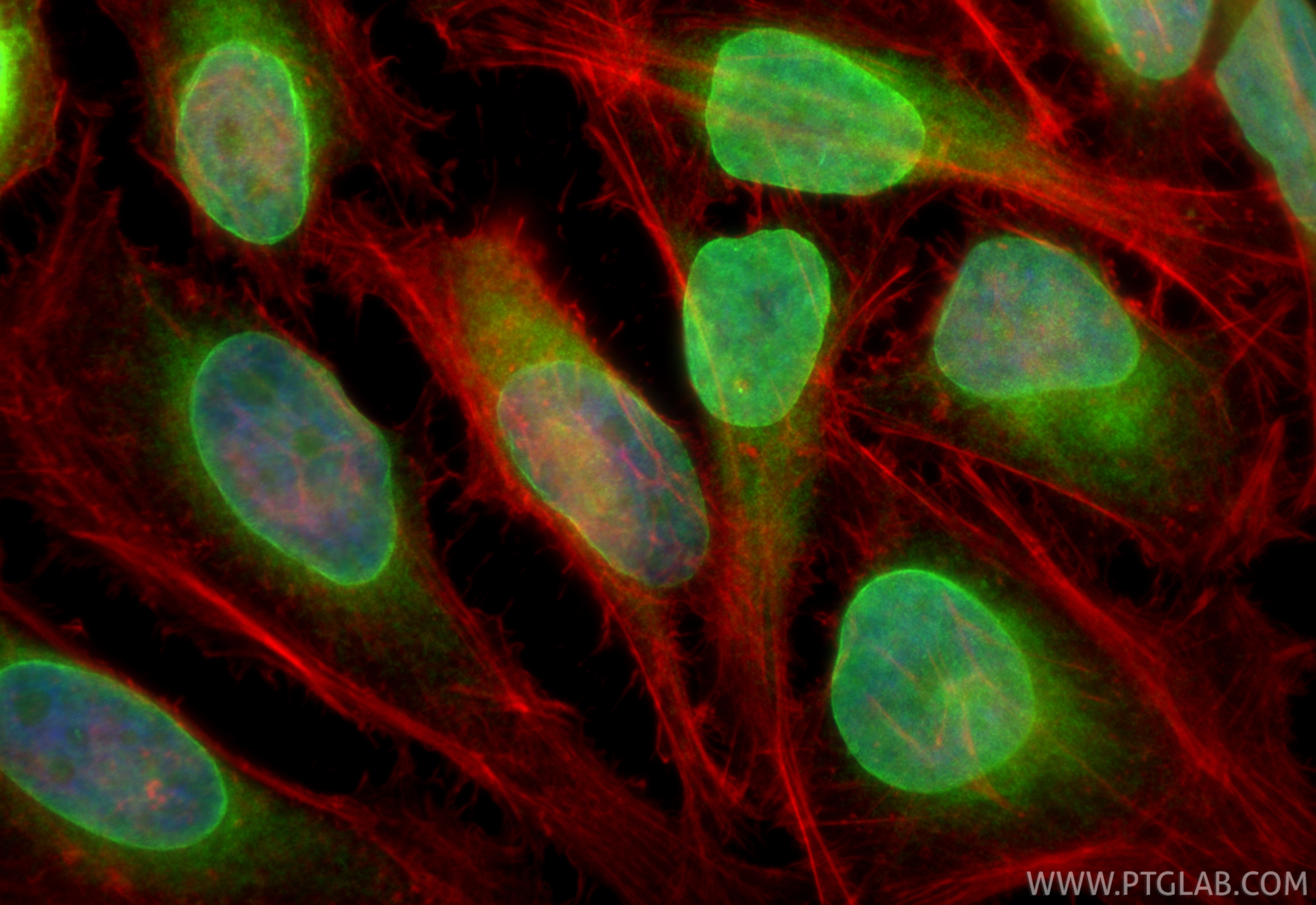 Immunofluorescent analysis of (4% PFA) fixed HeLa cells using LBR antibody (84522-7-RR, Clone: 241864G10 ) at dilution of 1:1000 and CoraLite®488-Conjugated Goat Anti-Rabbit IgG(H+L) (<a class='green' href='/productredirect?CatalogNo=SA00013-2' target='_blank'>SA00013-2</a>), CL594-Phalloidin (red). IF Staining of HeLa using 84522-7-RR