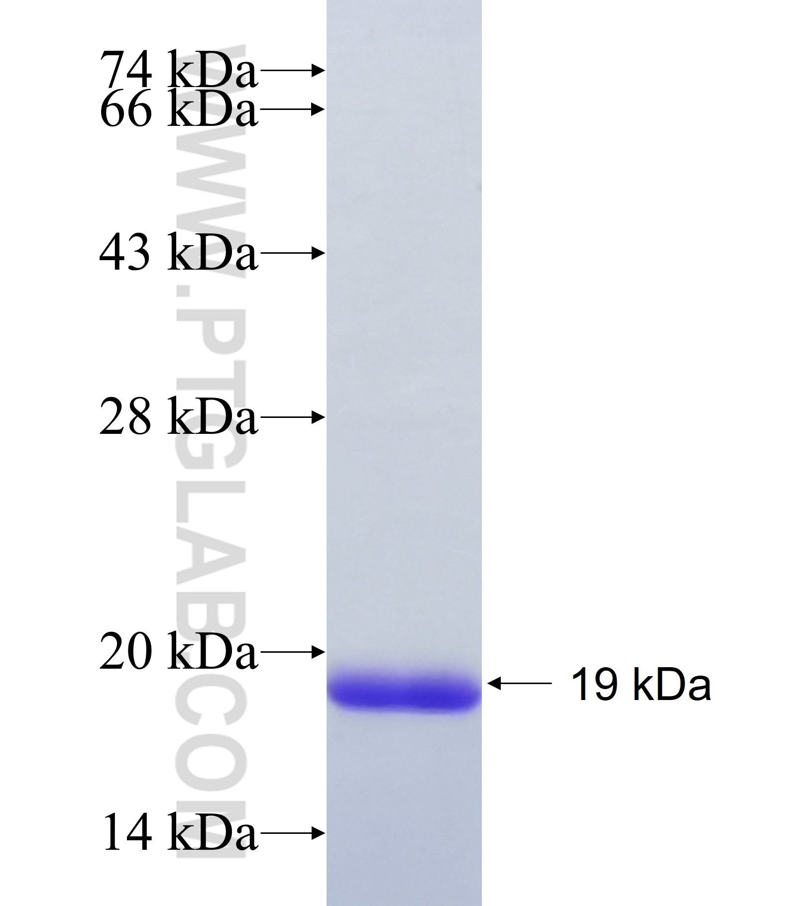 LBX1 fusion protein Ag40941 SDS-PAGE LBX1 fusion protein Ag40941 SDS-PAGE