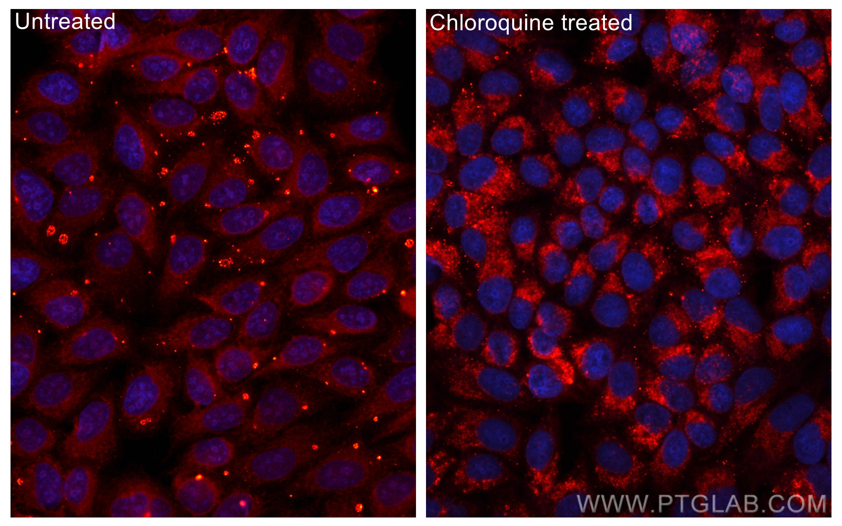 IF Staining of HepG2 using CL594-14600