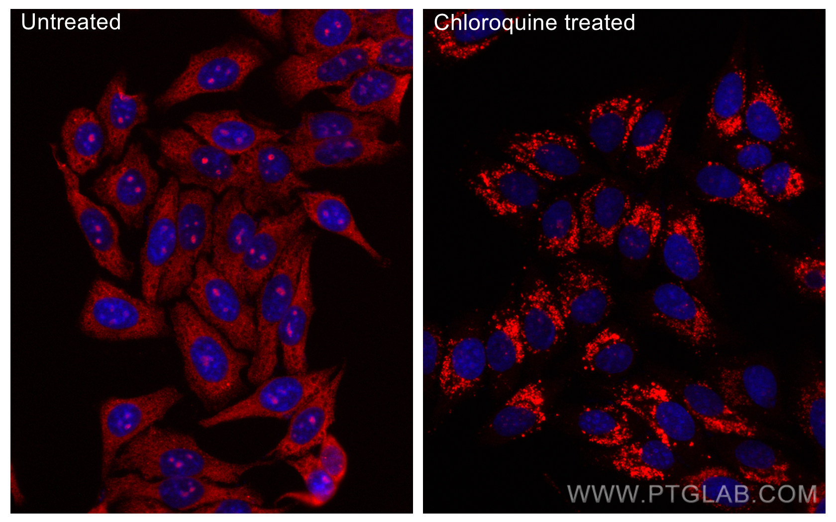 IF Staining of HepG2 using CL594-81004