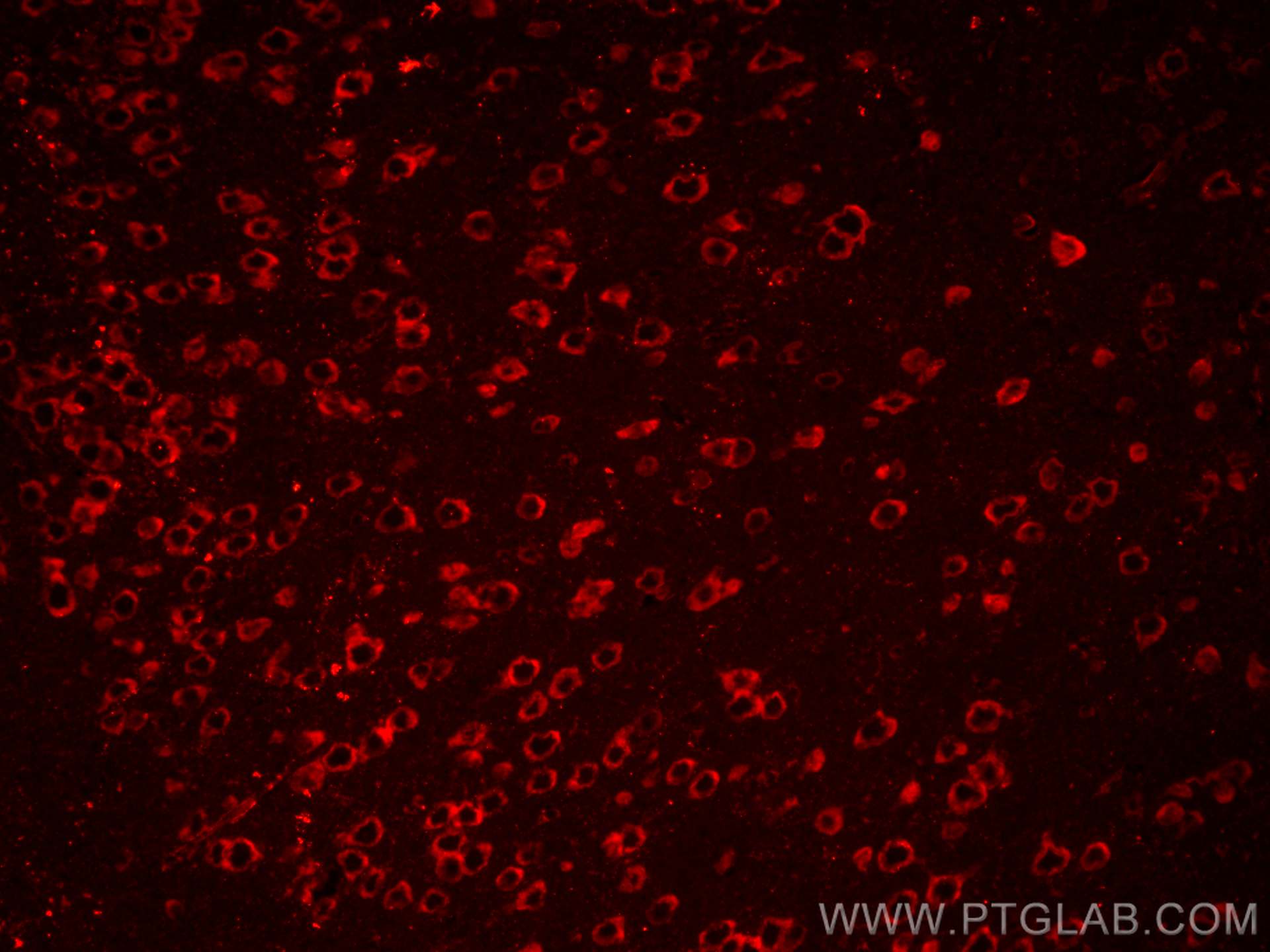 IF Staining of mouse brain using CL594-18725