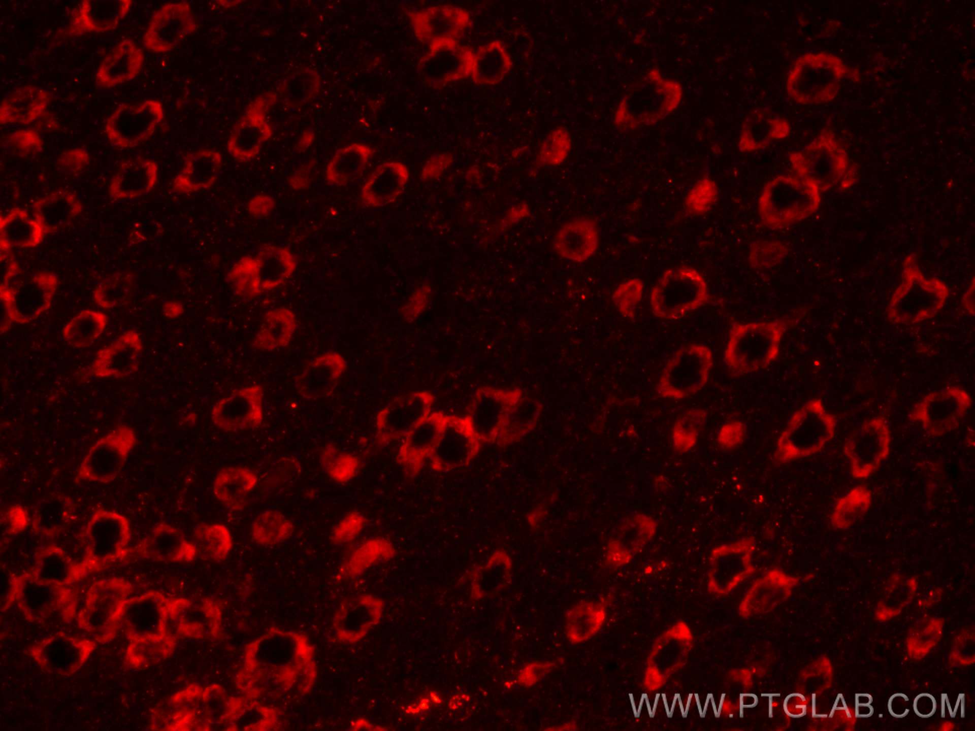 IF Staining of mouse brain using CL594-18725
