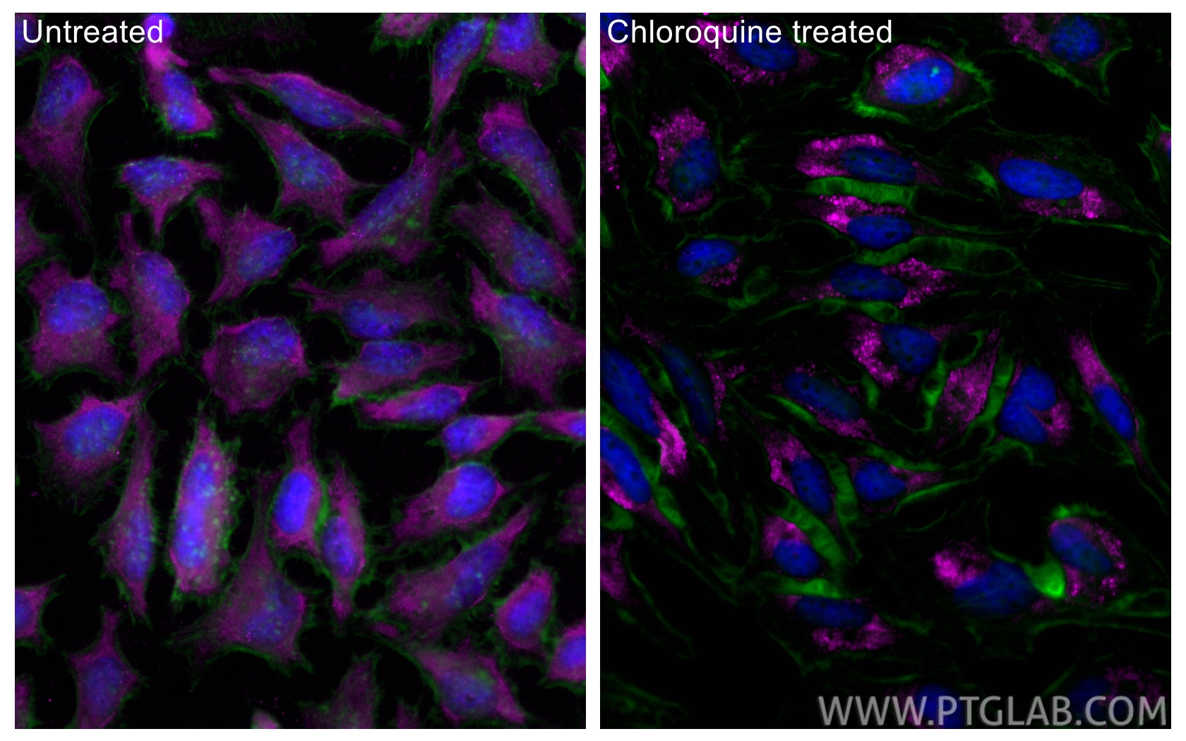 IF Staining of HeLa using CL647-18725 IF Staining of HeLa using CL647-18725