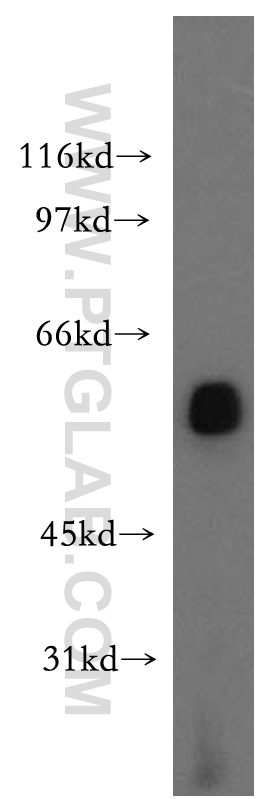 WB analysis of mouse testis using 12243-1-AP