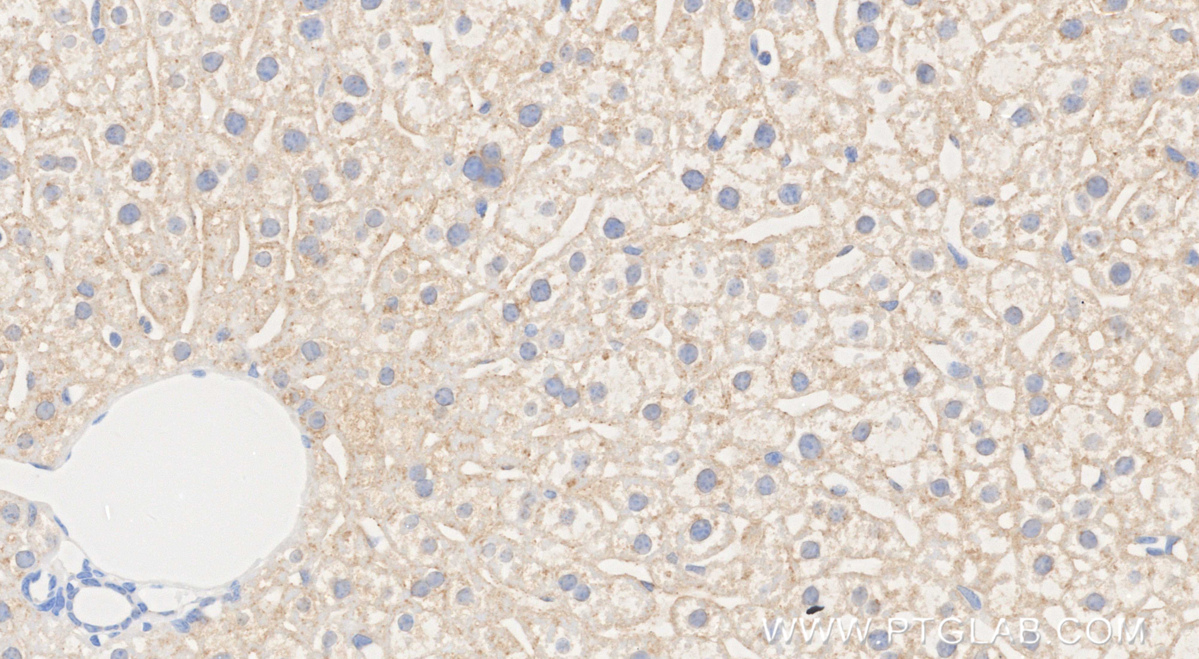 IHC staining of mouse liver using 86041-1-RR