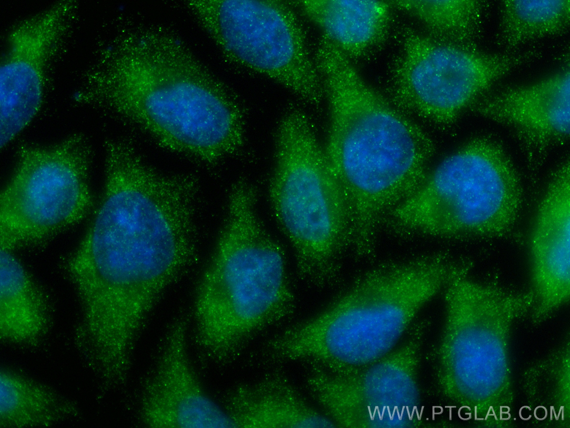 IF Staining of A375 using 21771-1-AP