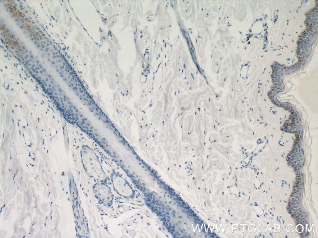 IHC staining of human skin using 21771-1-AP