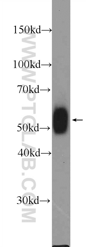 WB analysis of mouse thymus using 24497-1-AP