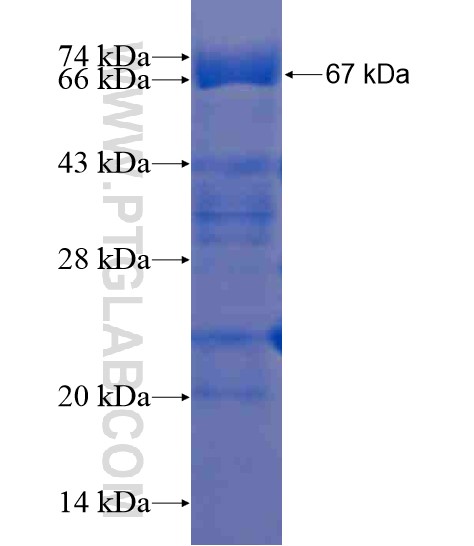 LCK fusion protein Ag21475 SDS-PAGE