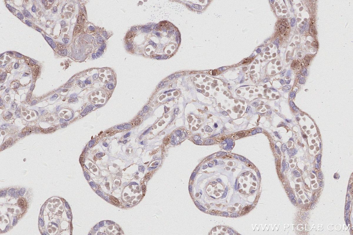 IHC staining of human placenta using 30222-1-AP