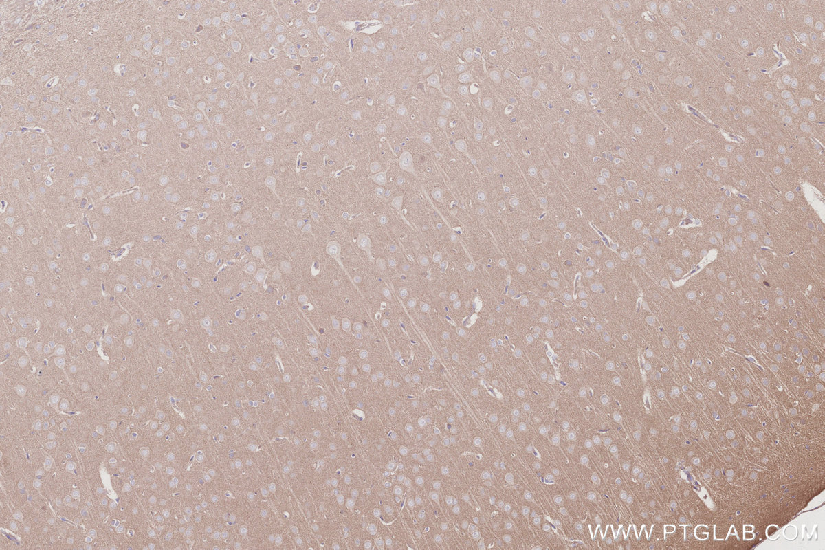 IHC staining of rat brain using 30222-1-AP