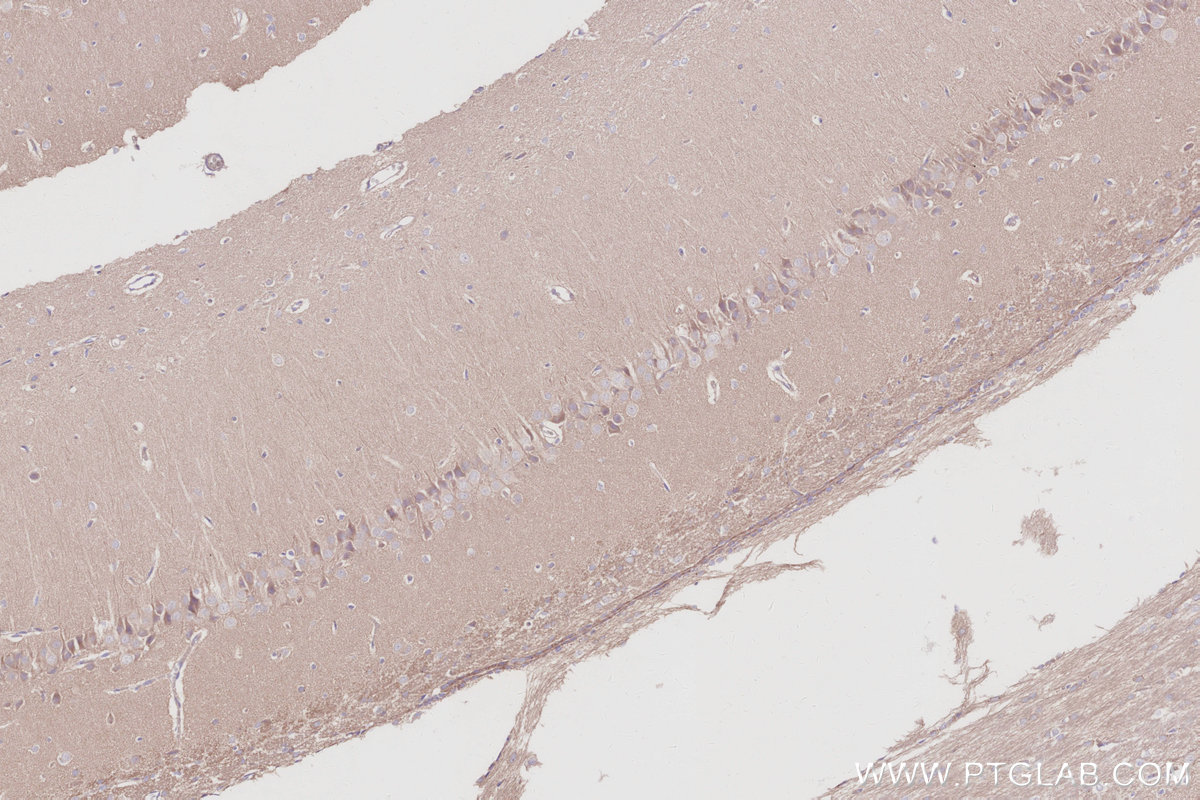 IHC staining of rat brain using 30222-1-AP