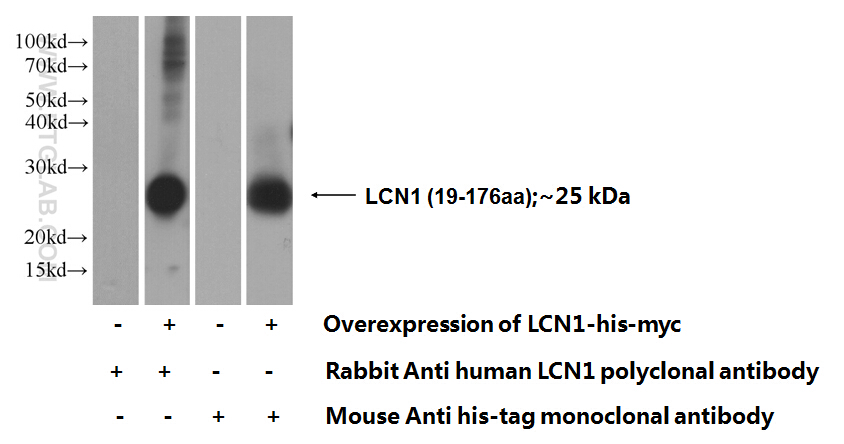 LCN1