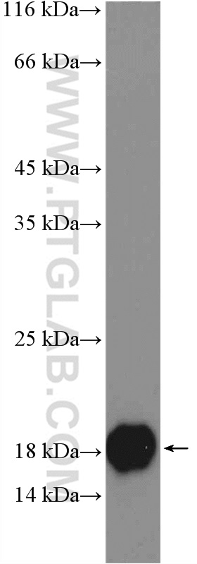 WB analysis of human saliva using 17900-1-AP