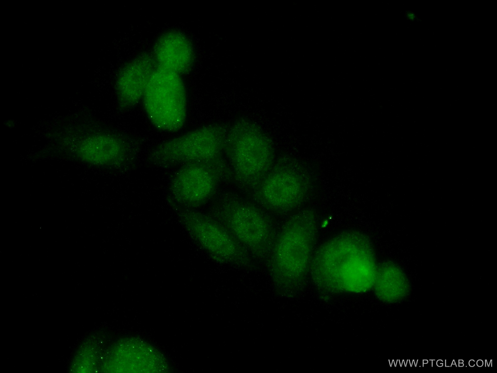 IF Staining of HeLa using 14476-1-AP