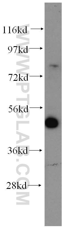 WB analysis of HeLa using 14476-1-AP