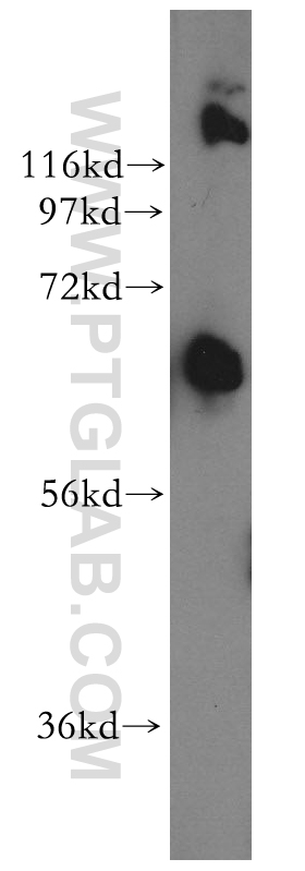 WB analysis of mouse testis using 17468-1-AP