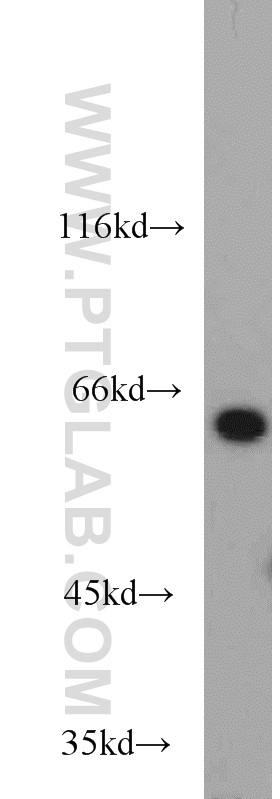 L-Plastin Polyclonal antibody