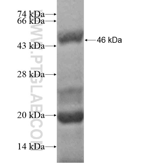 LCP1 fusion protein Ag19253 SDS-PAGE LCP1 fusion protein Ag19253 SDS-PAGE