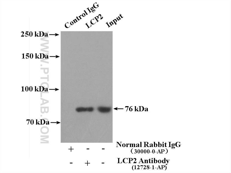 IP experiment of Jurkat using 12728-1-AP