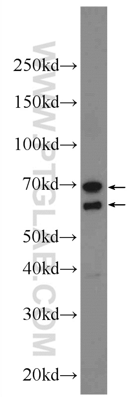 WB analysis of MCF-7 using 24589-1-AP