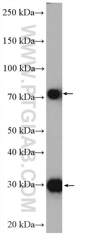 WB analysis of mouse skeletal muscle using 11004-1-AP