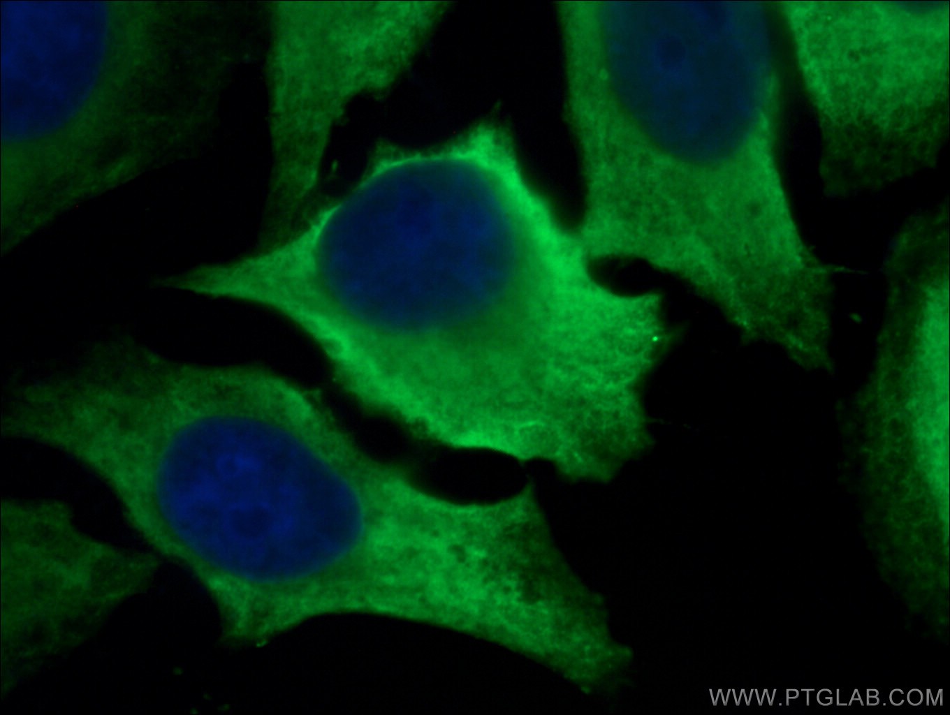 IF Staining of HepG2 using 21799-1-AP