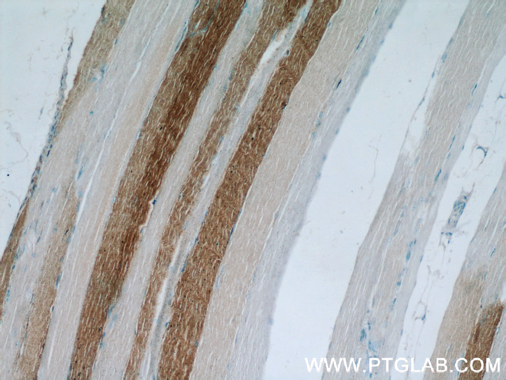 IHC staining of human skeletal muscle using 21799-1-AP