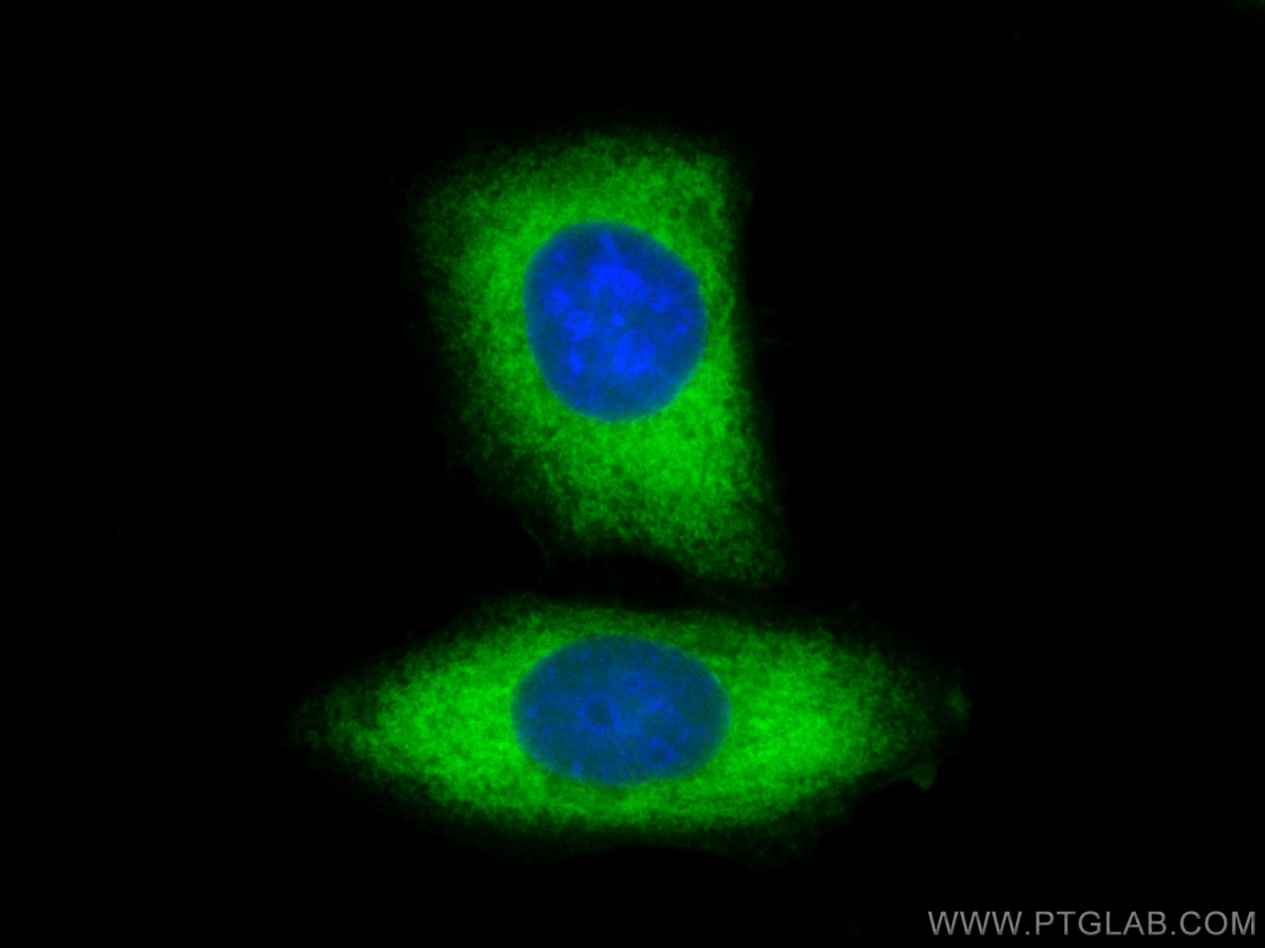 IF Staining of HepG2 using 19987-1-AP