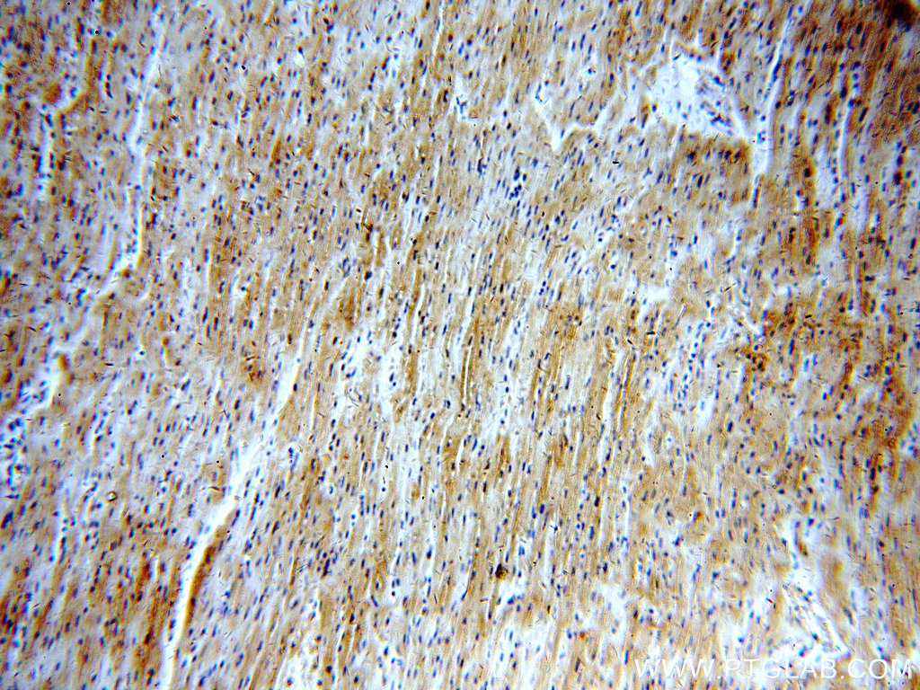 IHC staining of human heart using 19987-1-AP