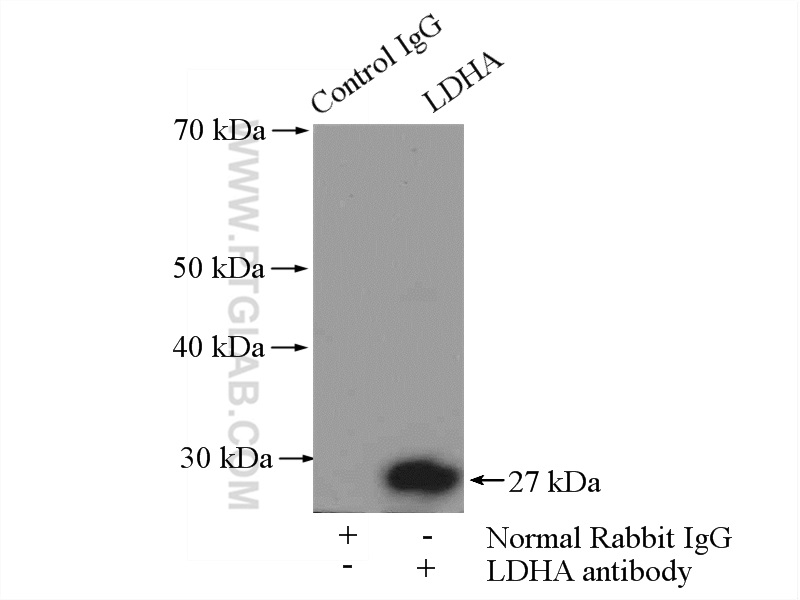 IP experiment of mouse kidney using 19987-1-AP