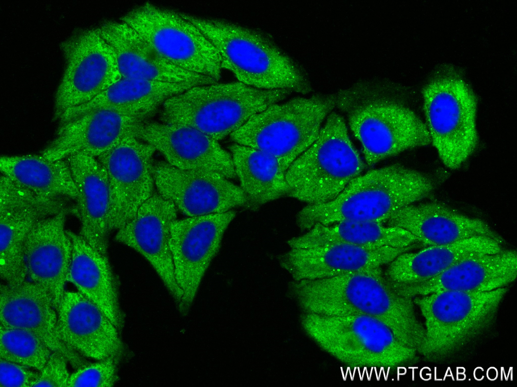 IF Staining of HepG2 using 84198-1-RR
