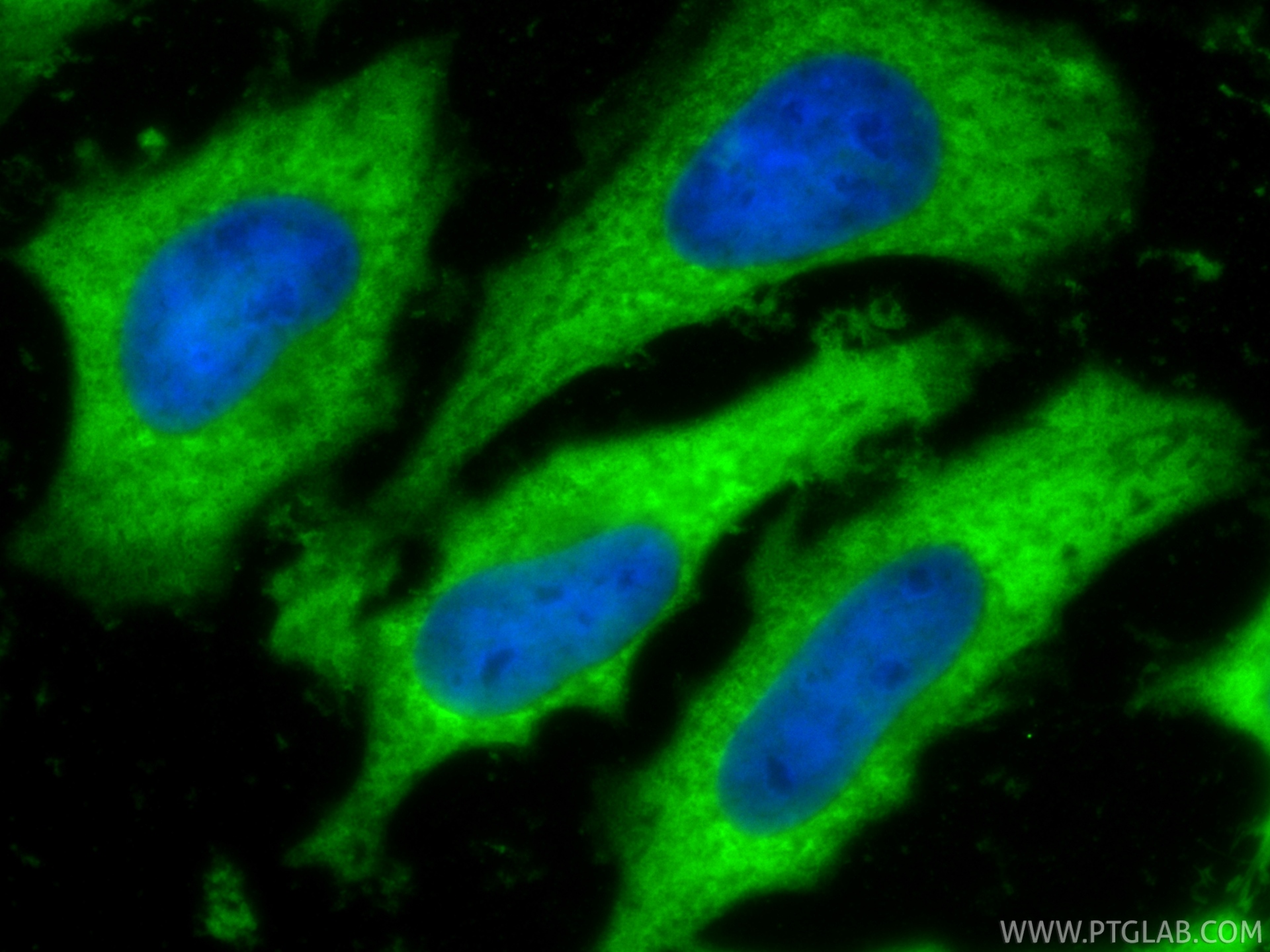 IF Staining of HeLa using 14824-1-AP