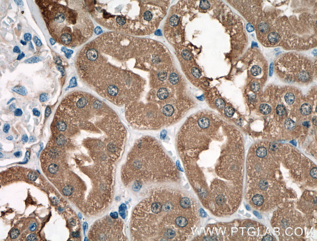 IHC staining of human kidney using 14824-1-AP