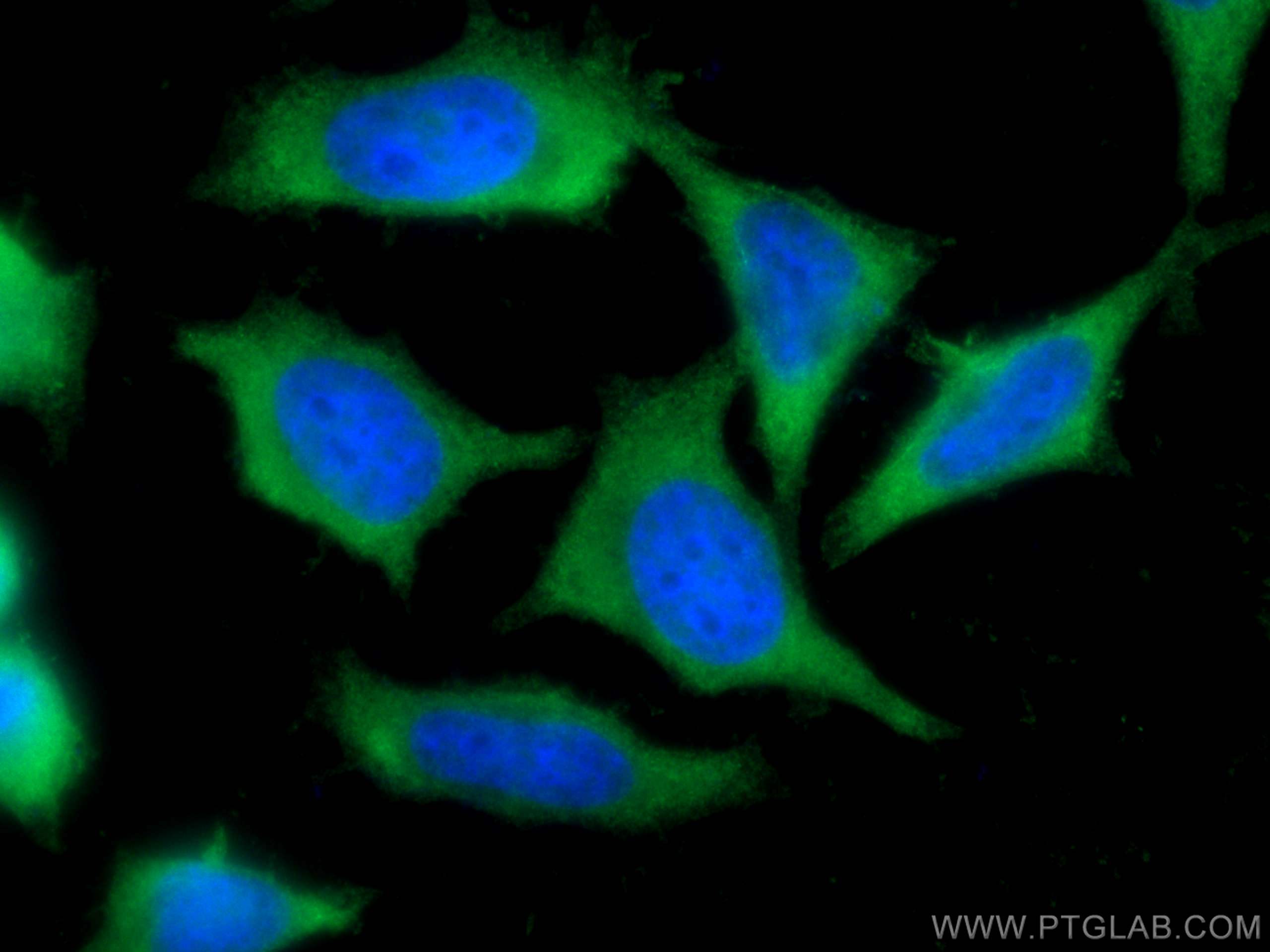 IF Staining of HeLa using 66425-1-Ig (same clone as 66425-1-PBS)