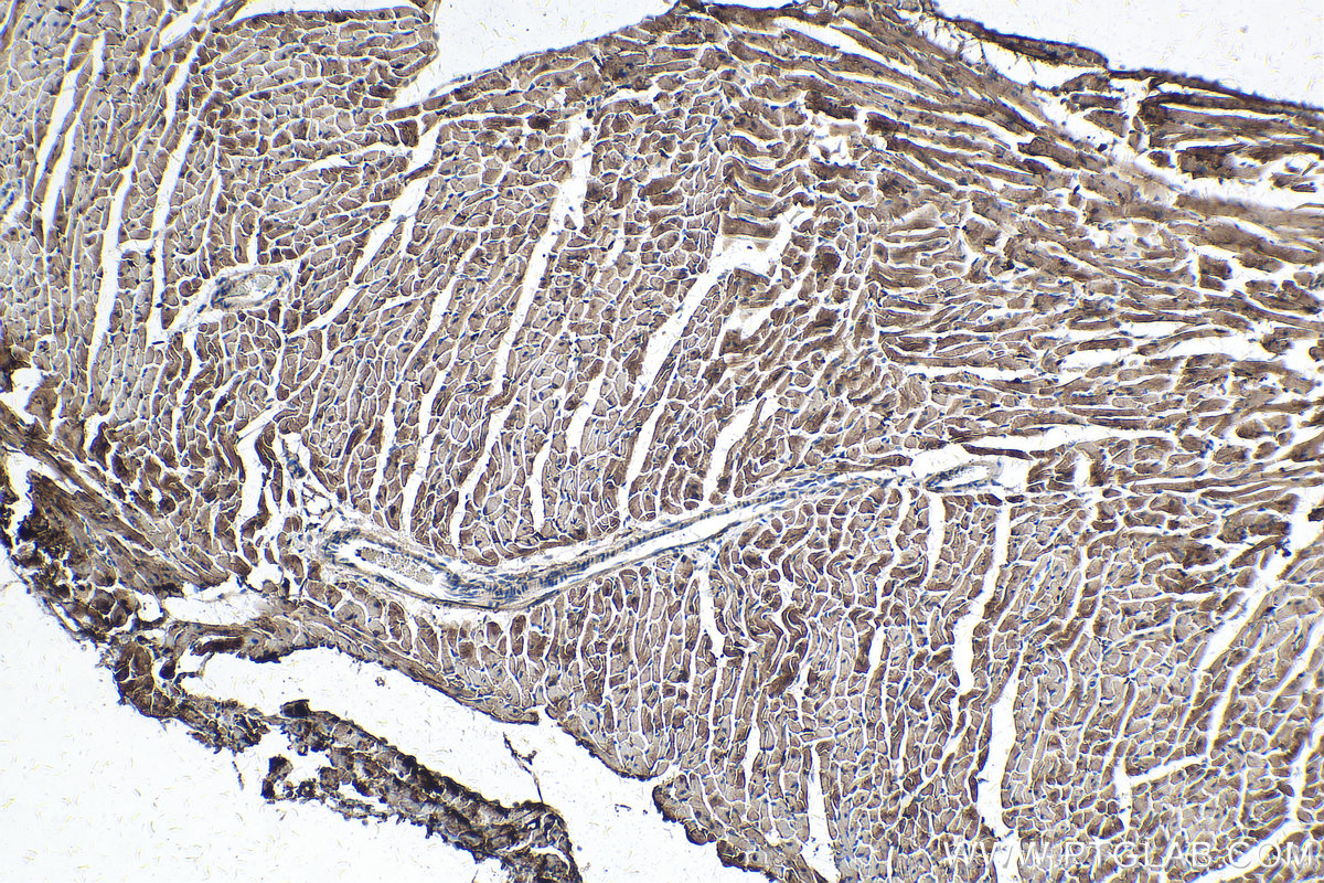 IHC staining of mouse heart using 66425-1-Ig (same clone as 66425-1-PBS)