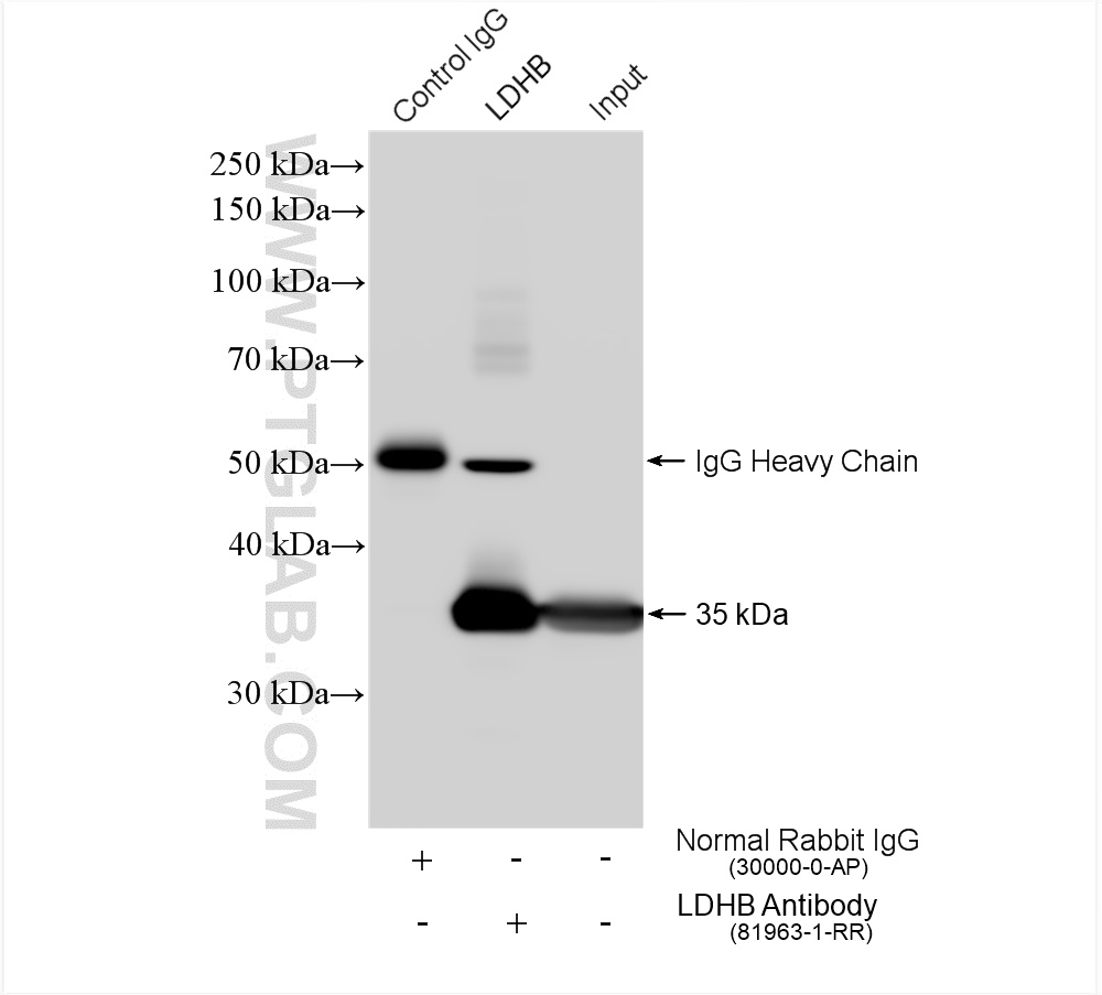 IP experiment of HeLa using 81963-1-RR (same clone as 81963-1-PBS)
