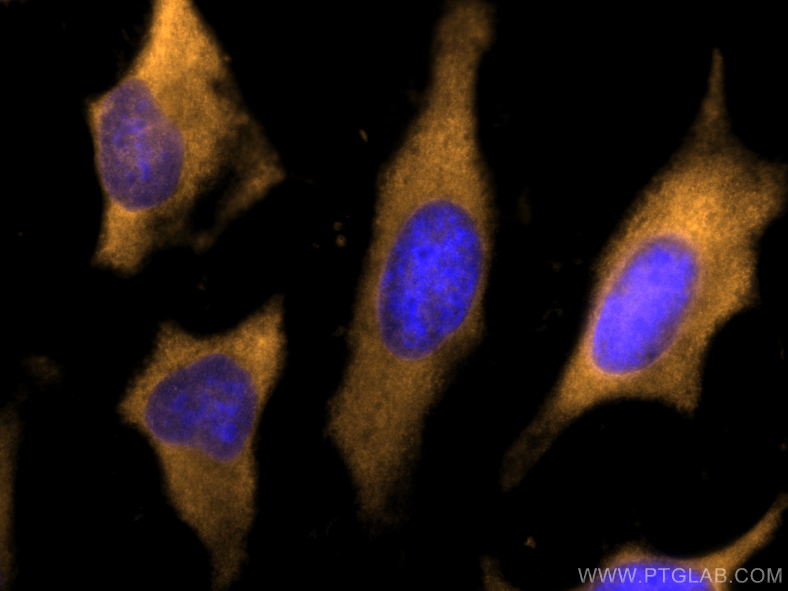 IF Staining of HeLa using CL555-14824